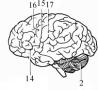 analysis of C Presson's brain, demonstrating extreme mental prowess.